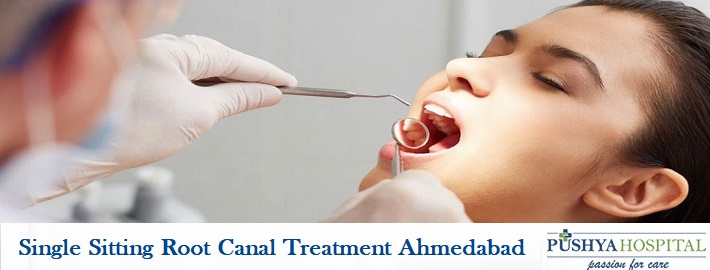 Single Sitting Root Canal Treatment Ahmedabad